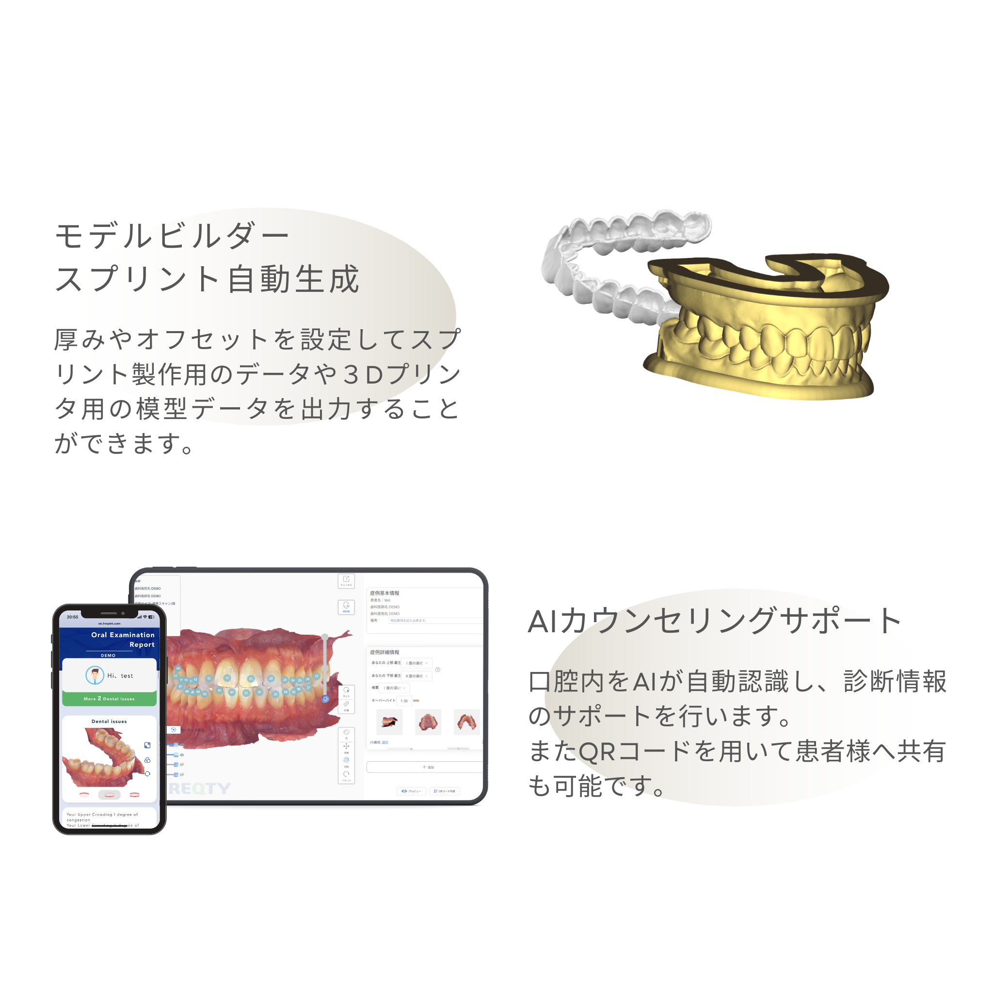 神樂 KAGURA Smart 口腔内スキャナ
