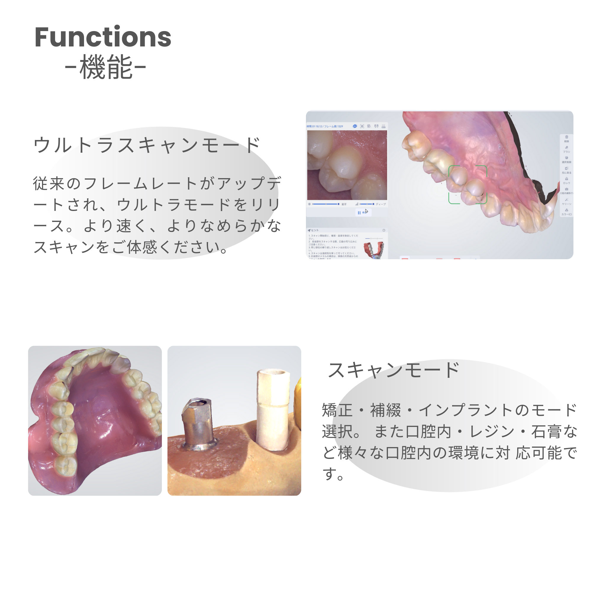 神樂 KAGURA Smart 口腔内スキャナ