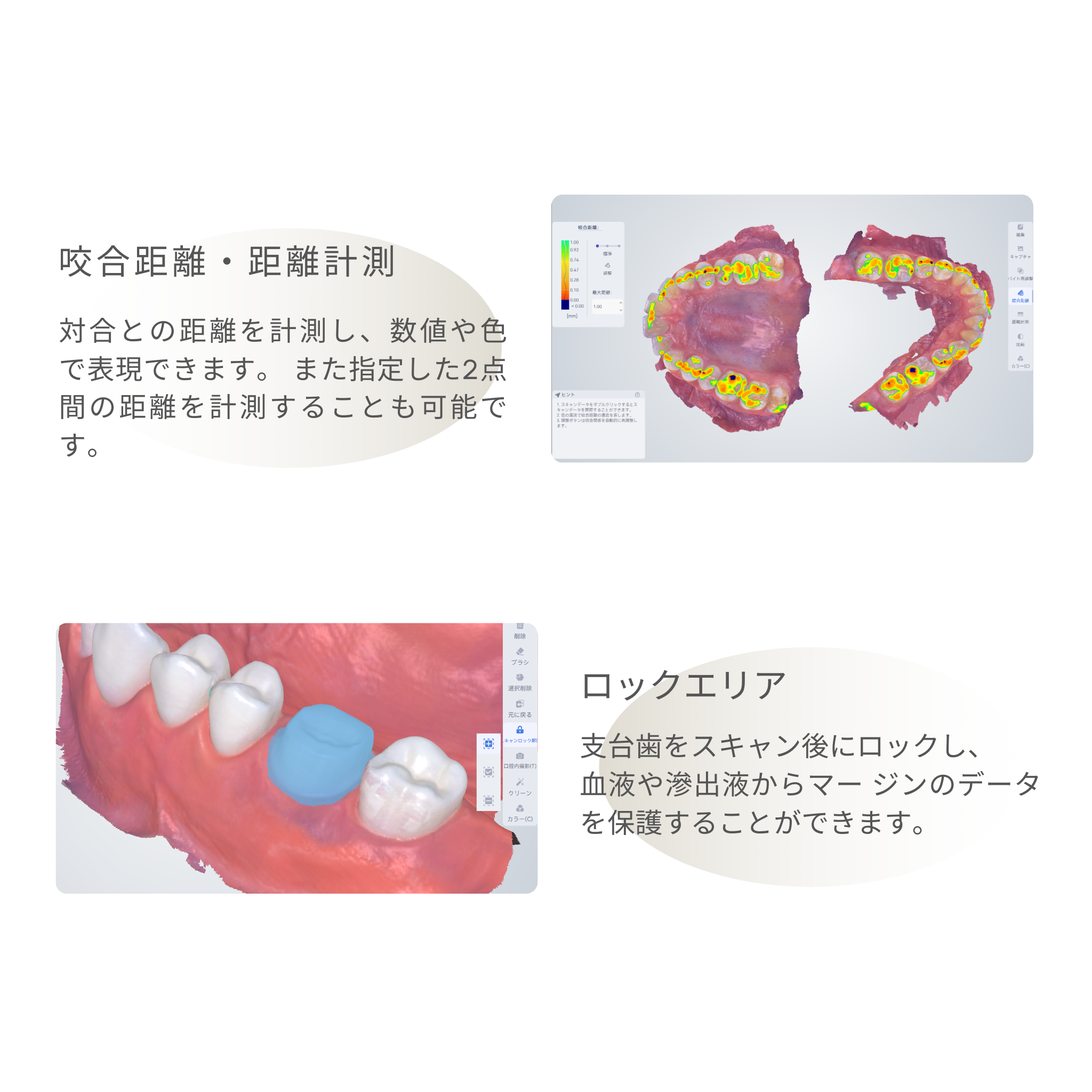 神樂 KAGURA Smart 口腔内スキャナ