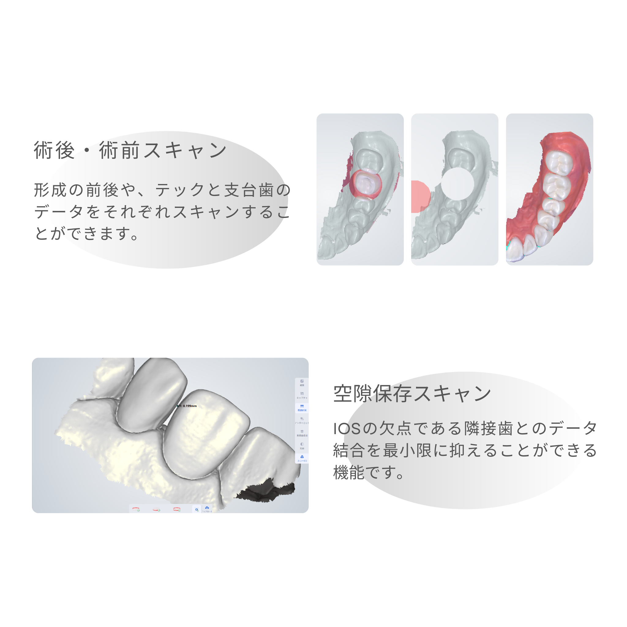 神樂 KAGURA Smart 口腔内スキャナ