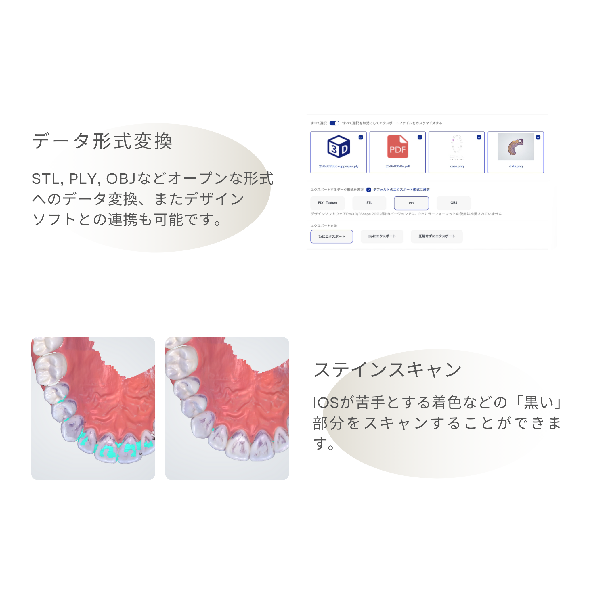 神樂 KAGURA 口腔内スキャナ