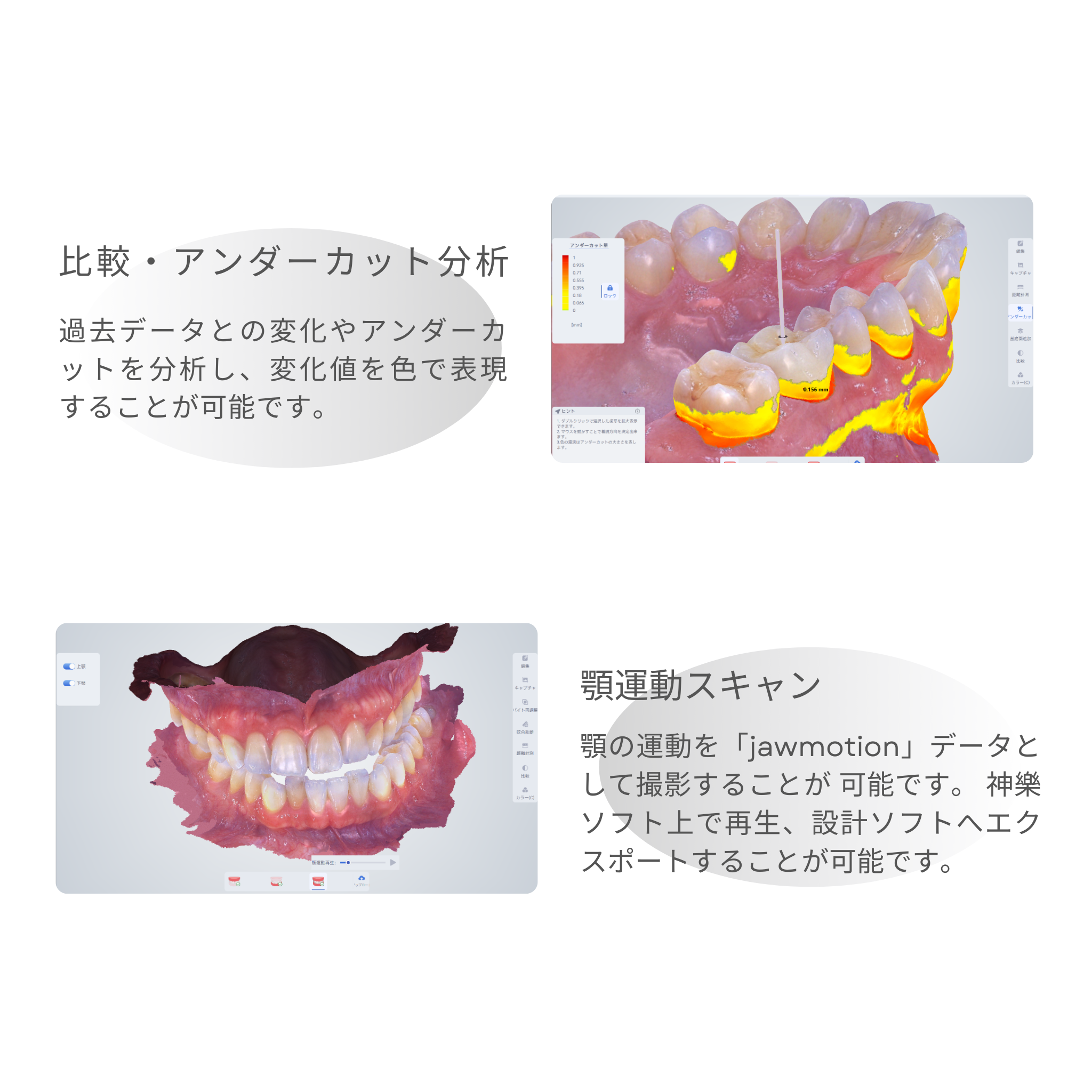 神樂 KAGURA 口腔内スキャナ